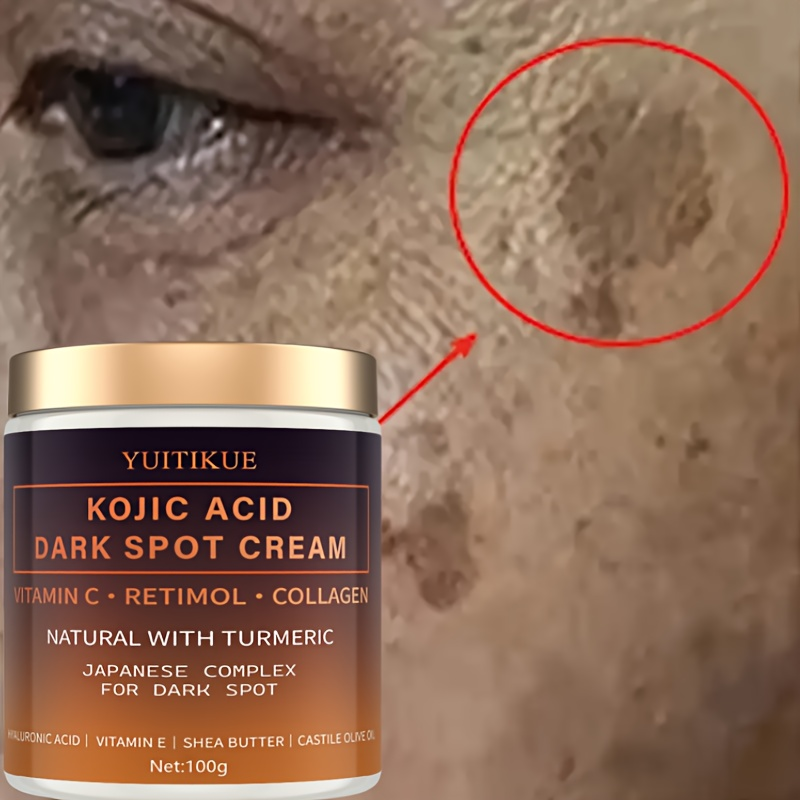 Shea Butter Raw - Crema sbiadita di arbutina, vitamina C,